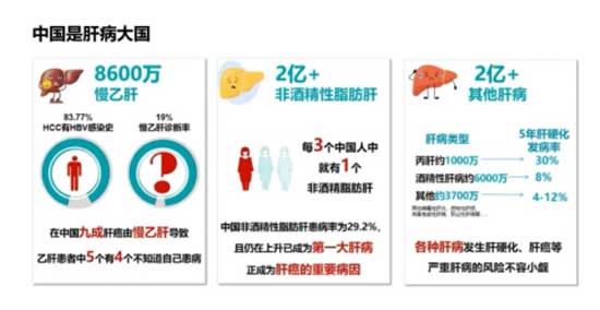 河南省啟動(dòng)全國(guó)慢性肝病大型查治雙扶活動(dòng)